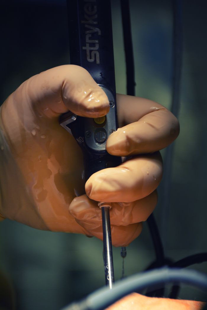 services-01 Close-up of a surgeon's gloved hand holding a surgical tool during an operation.