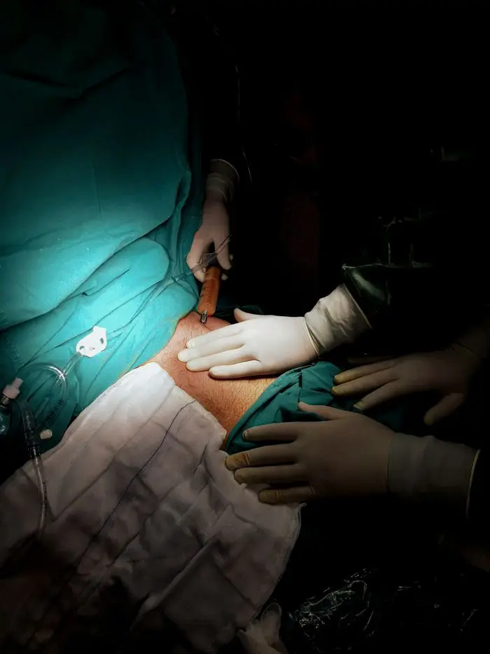 Close-up of surgeons' hands performing surgery in a sterile operating room environment.